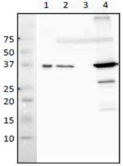 RecA | Recombinase A in the group Antibodies Other Species / Bacteria at Agrisera AB (Antibodies for research) (AS21 4542)